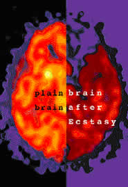 Ecstasy Brain Pictures